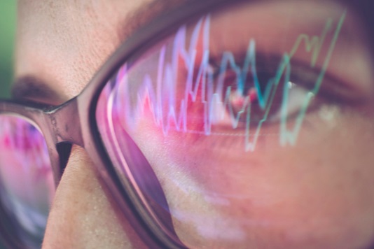 見れば見るほど間違える チャートの予測と認知バイアス