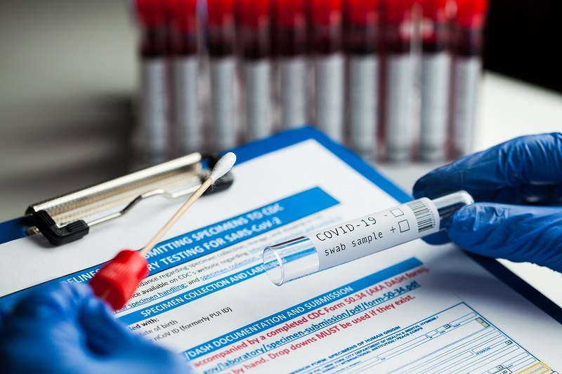 PCR検査を巡るドロ沼の様相